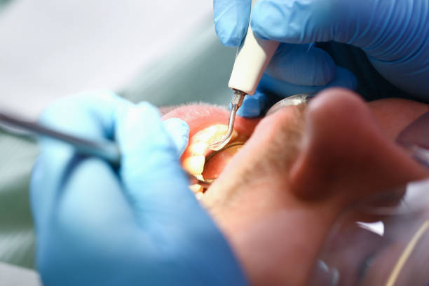 Best Emergency Broken Tooth Repair in Mountain Home Af, ID