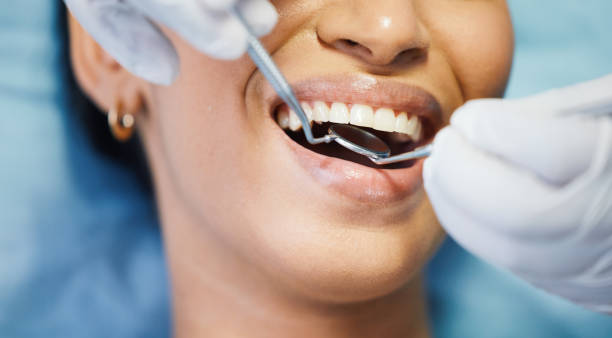 Best Emergency Tooth Extraction in Mountain Home Af, ID